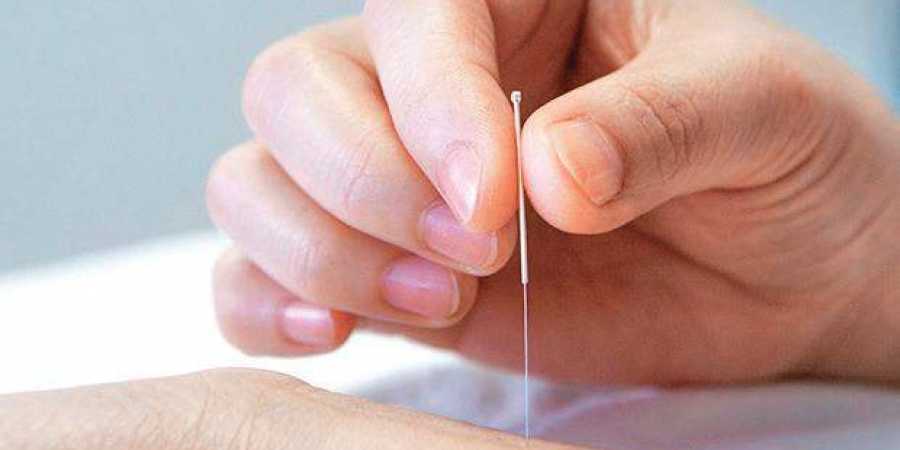 acupuncture for fertility male